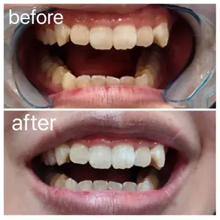 Twinkle White上尾店のエステ・リラクイメージ