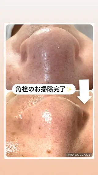 W MISATOのエステ・リラクイメージ