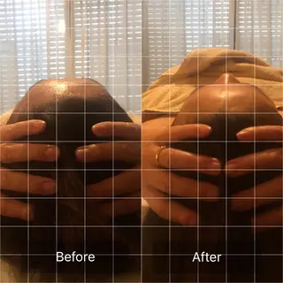 OfuSalon PARAFUSE.のエステ・リラクイメージ