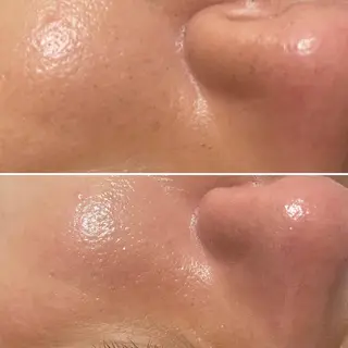 アイブロウ マツエク・マツパ キッズ メンズ Epina 千葉店 【エピナ】のエステ・リラクイメージ