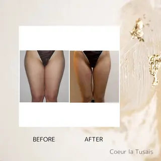 coeur la tusais ゆうきのエステ・リラクイメージ