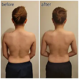 ラジオ波温活エステ✨ yumiのエステ・リラクイメージ