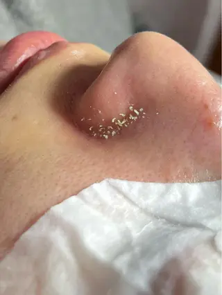 private salon OUKA所属・OUKA脱毛 毛穴ケアフェイシャルのエステ・リラクイメージ