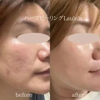 美腸サロン🌺 腸もみ/小顔/リンパのエステ・リラクイメージ