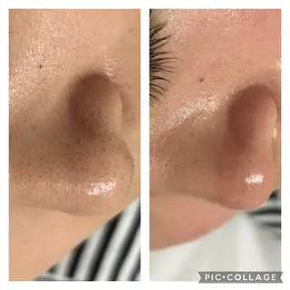 BeautySalonGemmy所属・Gemmy 愛美のエステ・リラクイメージ