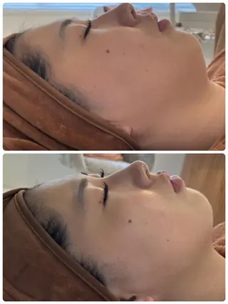 FLEUR🫧 フェイシャルのエステ・リラクイメージ