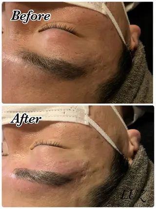 メンズ アイブロウ メンズフェイシャル アイブロウ・ルースのエステ・リラクイメージ