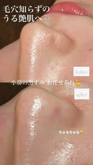 chouchou【シュシュ】所属・トータルボディケア chouchouのエステ・リラクイメージ