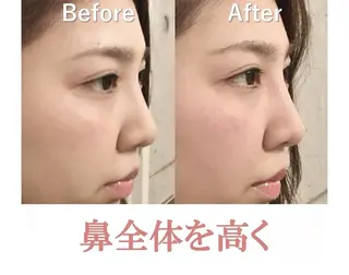 美鼻&小顔専門店 ラプリ 毛井のエステ・リラクイメージ