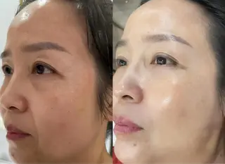 ネイル aliaハイフ&水光ジェットサロン所属・aliaハーブ水光店 エステティシャン募集のエステ・リラクイメージ