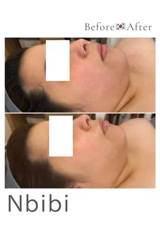 韓国🇰🇷価格 サロン_Nbibiのエステ・リラクイメージ