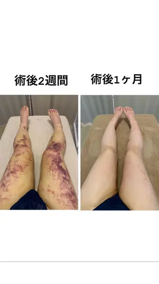 メディカル インディバサロン同心のエステ・リラクイメージ