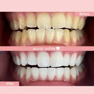 セルフホワイトニング エクシア札幌琴似店のその他イメージ