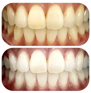 ヘアメイクサロン Red Lipps のマツエク・マツパデザイン