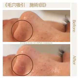 SUZUKI SHURIのエステ・リラクイメージ