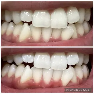 セルフホワイトニングサロン　Betee所属・セルフホワイトニング Beteeのエステ・リラクイメージ