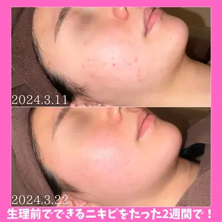 痩身&美肌サロン 堀米✨のその他イメージ