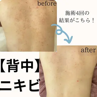 ニキビ改善専門店 d'Albaのエステ・リラクイメージ