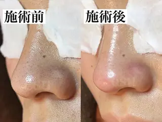 毛穴ケア専門店 esu(エス)のエステ・リラクイメージ