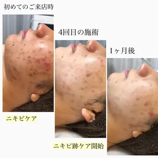 美肌脱毛と癒しのﾌﾟﾗｲﾍﾞｰﾄｻﾛﾝ。gratia~ｸﾞﾚｲﾃｨｱ~所属・gratia ~ｸﾞﾚｲﾃｨｱ~のエステ・リラクイメージ