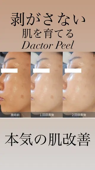 GrandAzure 大人の肌改善のエステ・リラクイメージ