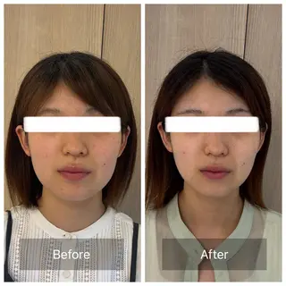 小顔矯正サロンAST【アスト】所属・小顔矯正サロン AST【アスト】のその他イメージ