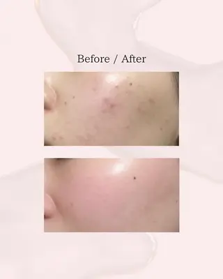 myherb所属・ニキビ肌改善サロン myherb🌿のエステ・リラクイメージ