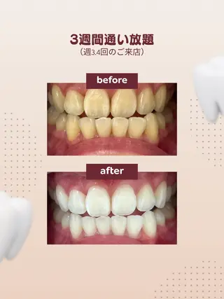 LIRA所属・プライベートサロン LIRAのその他イメージ