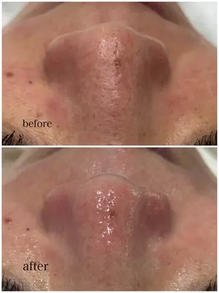 MY FAIR LADY所属・毛穴に特化したサロン MYFAIRLADYのエステ・リラクイメージ