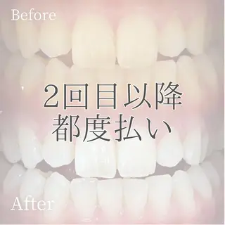 メンズ キッズ ホワイトニング ショップ多摩店のその他イメージ