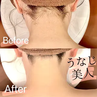 都度払い脱毛 BARNEYのエステ・リラクイメージ