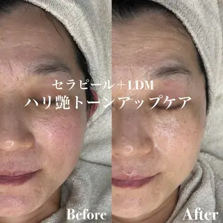 韓国肌管理&小顔 ＩＲＯＨＡのエステ・リラクイメージ