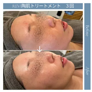 Blue Moon 【ブルームーン】のエステ・リラクイメージ