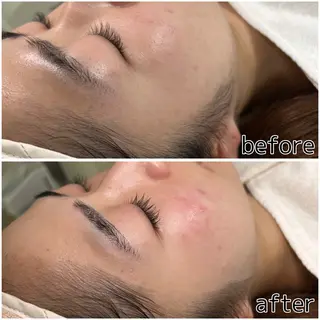 SHECIAお顔剃りシェービング専門店所属・お顔剃りエステサロン SHECIAのその他イメージ