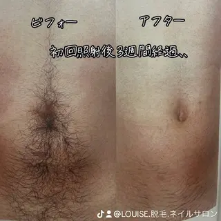 LOUISE.／脱毛所属・LOUISE. ／脱毛のエステ・リラクイメージ