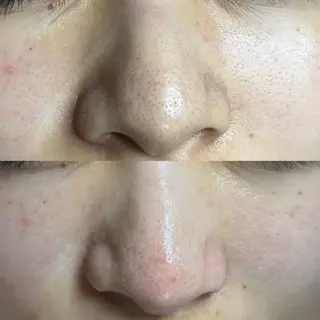 毛穴ケア・ヘッドスパサロンSHINY(シャイニー)所属・毛穴ケア・ヘッドスパ サロンSHINYのエステ・リラクイメージ