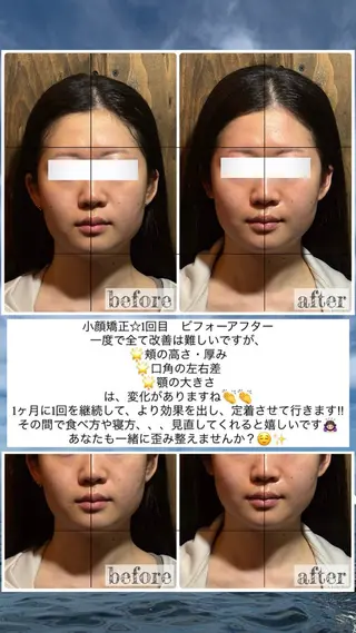 💎後悔させない小顔 矯正💎イトヤマ🌱のエステ・リラクイメージ