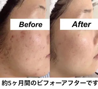 都度払い肌質改善 &脱毛Blancheのエステ・リラクイメージ