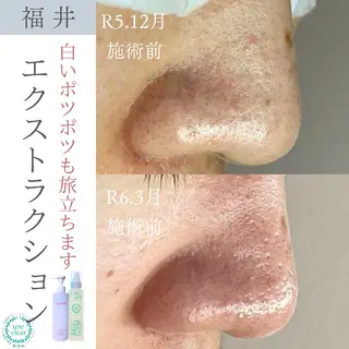 毛穴肌質ケアサロン Yourmeユアミーのエステ・リラクイメージ