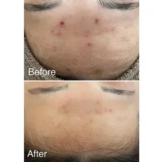 美時雨・bishigure所属・美時雨 bishigureのエステ・リラクイメージ