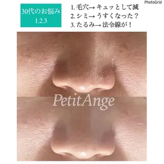 プチアンジェ所属・艶肌&小顔リフト❤︎ プチアンジェ茅ヶ崎のエステ・リラクイメージ