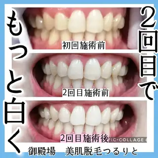 美肌脱毛サロン つるりと御殿場店所属・美肌脱毛サロン つるりとのその他イメージ