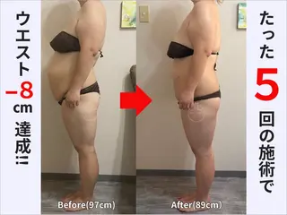 骨盤矯正ダイエット ぷりんす整体COZYのエステ・リラクイメージ