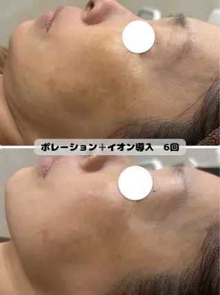 菊地 そらのエステ・リラクイメージ