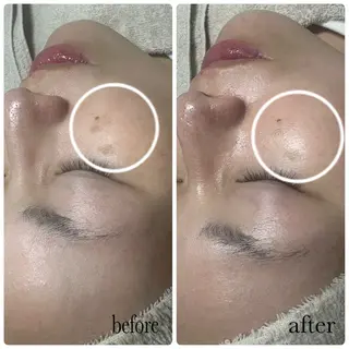 HALU _HARUのエステ・リラクイメージ