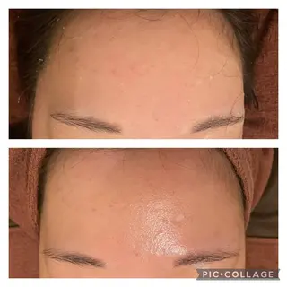 セミロング カラー パーマ ヘアアレンジ メンズ キッズ ネイル マツエク・マツパ アイブロウ ニキビ特化型エステ 🍓最短で肌質改善のエステ・リラクイメージ