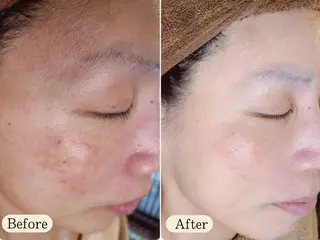 UILANI所属・UI LANIのエステ・リラクイメージ