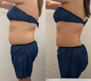 脂肪冷却/エステ COCOKARAのエステ・リラクイメージ