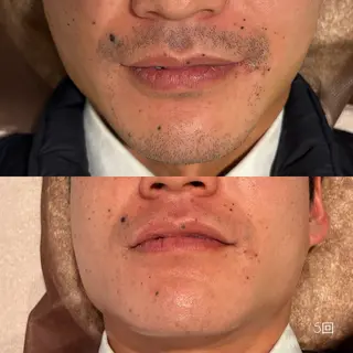 メンズ Lassy Yuriの眉毛・アイブロウイメージ