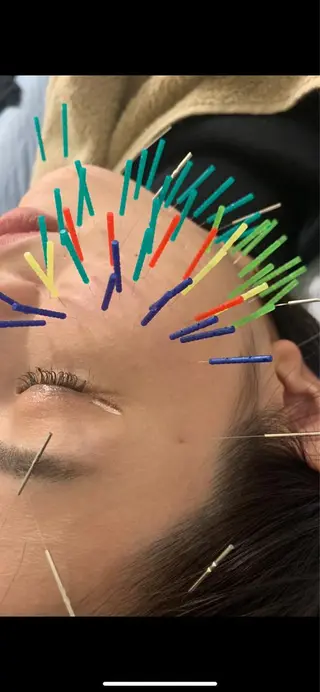 表参道鍼灸院K 美容鍼🔮ララピールのエステ・リラクイメージ